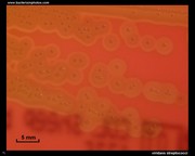 alpha hemolysis